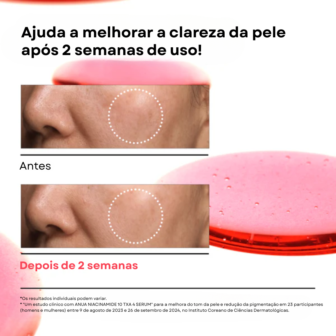 Sérum Niacinamida 10% + TXA 4%