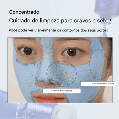 Medicube Zero Pore Blackhead Mud Mask – Máscara Purificante para Cravos e Poros