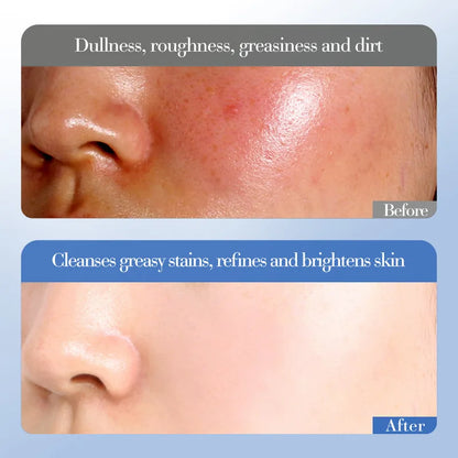 Conjunto de Cuidados Essenciais com a pele, soro facial clareador, creme removedor de rugas, encolhe os poros, desbota, melanina opaca, hidrata e ilumina, (6 peças)