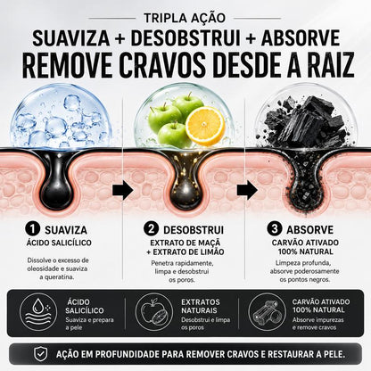 LANBENA Máscara Removedora de Cravos 2.0 com Carvão de Bambu